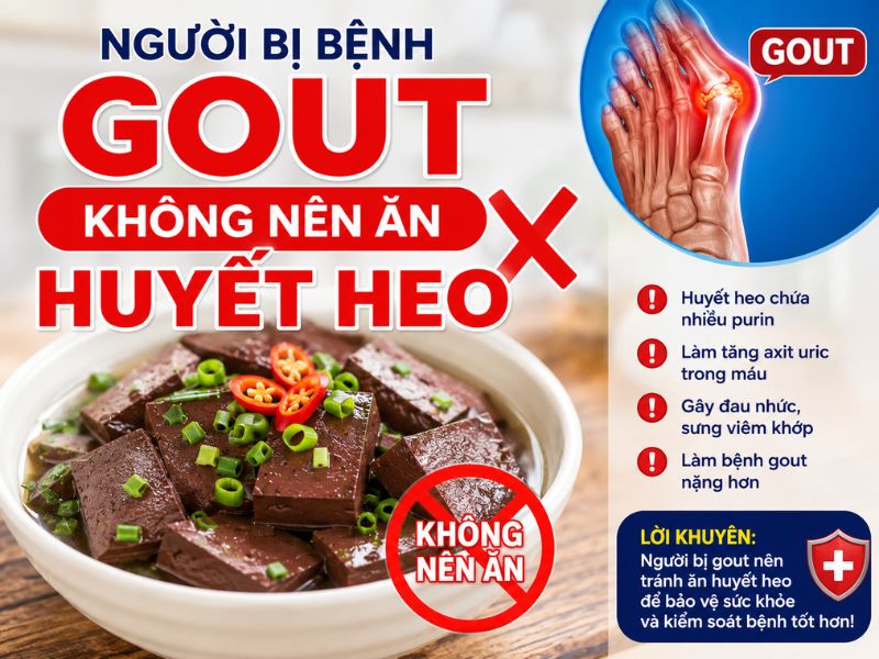 bi-mat-huyet-heo-ky-voi-gi